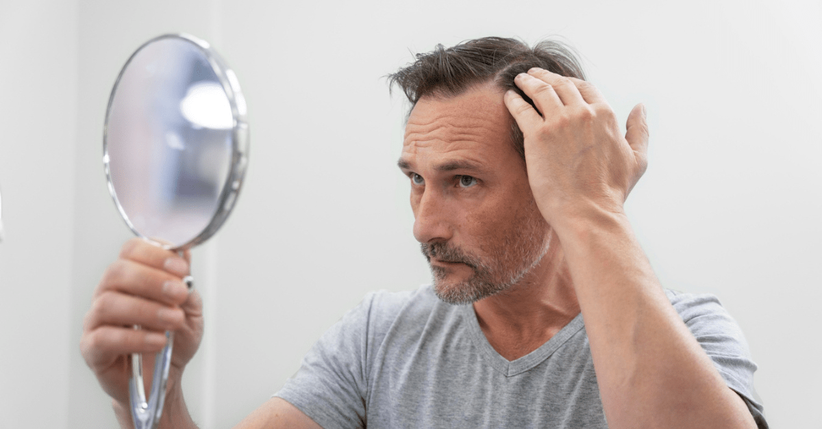 Hair Thinning