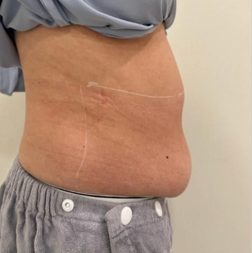 puretouch-bellyfat1 (3)