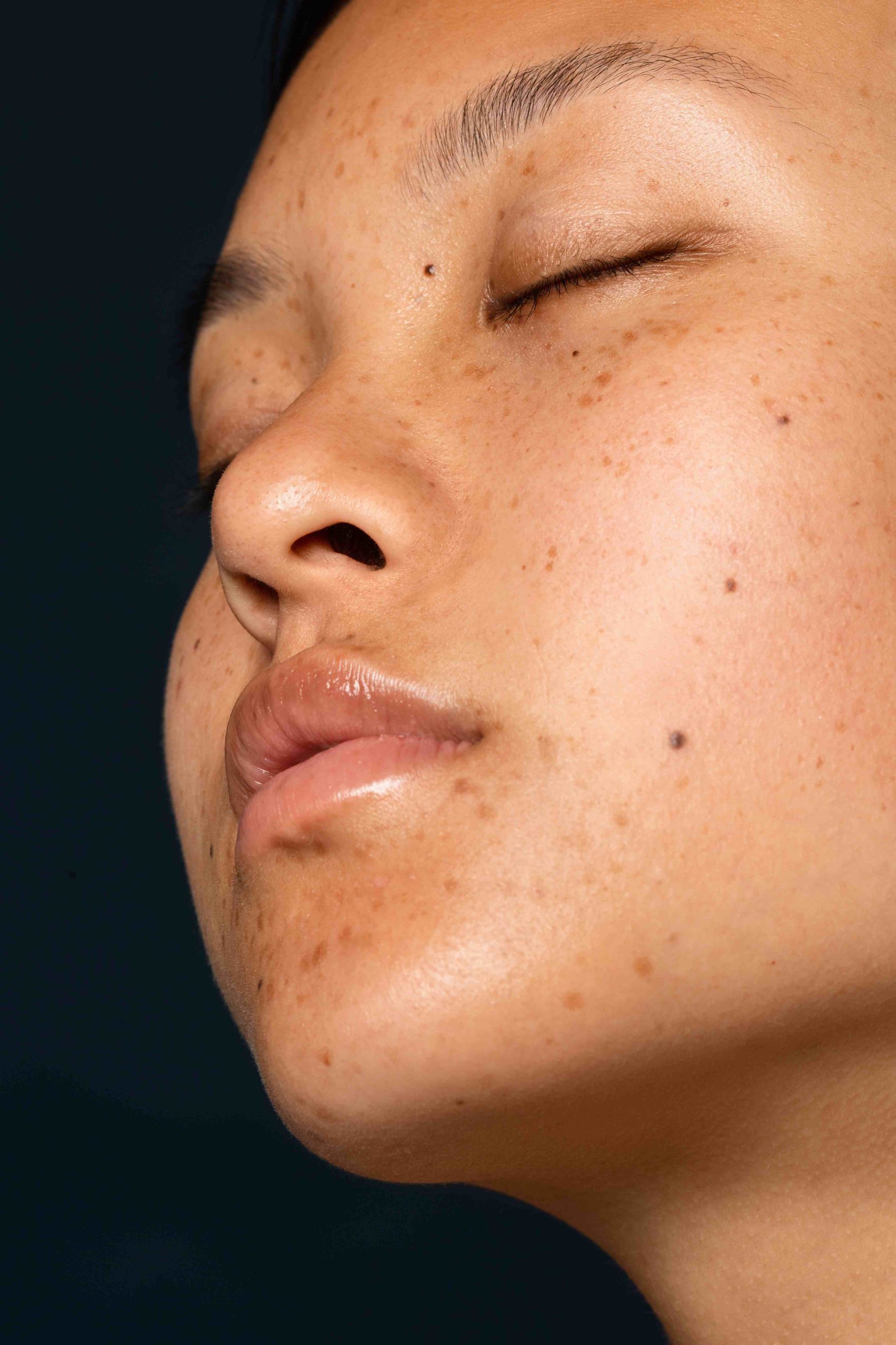 side-view-woman-skin-texture