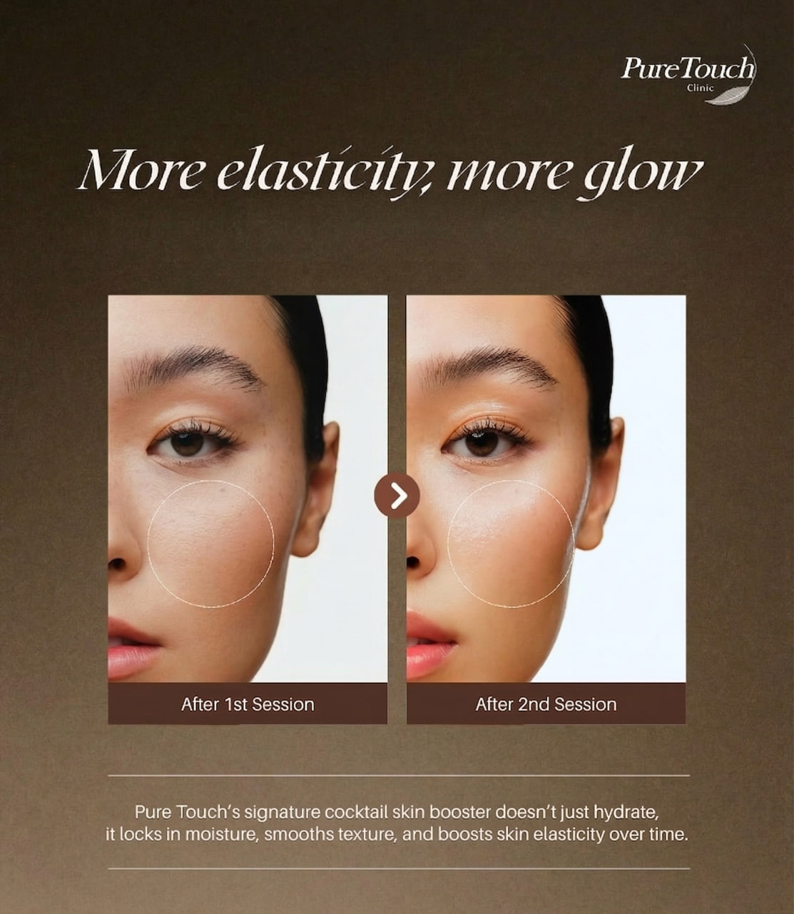 Signature Cocktail Skin Booster (Pure Touch)