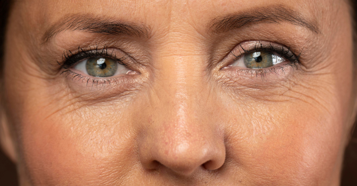 featured image pure touch under eye treatment